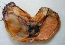 平潭特产有哪些?在哪里买?平潭特产可以带走的?